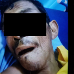 Geger, Warga Temukan Mayat Pria yang Diduga Tewas Dibunuh