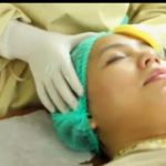 Dermalove Batam Tawarkan Treatment Terbaru Magicad lift Tanpa Jarum Foto: Istimewa