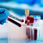 Varian Lambda, Jenis Virus Corona yang Lebih Tahan Vaksin Ilustrasi Varian Lambda | Foto: Istimewa