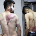 Dua Wartawan Afghanistan Dipukuli dalam Tahanan Polisi Taliban Saat meliput Demonstrasi di Kabul